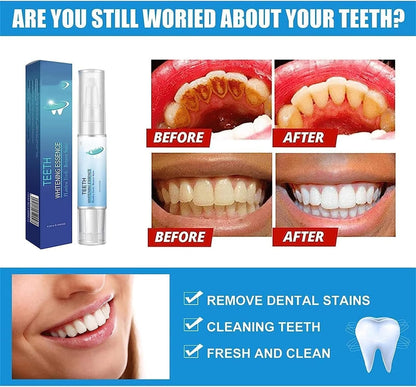 EZ LIVING 4ml Tooth Cleaning Pen – Teeth Whitening Essence for Effective Stain Removal, Plaque Cleaning, and Smile Brightening – Easy-to-Use Oral Care Tool for Daily Use