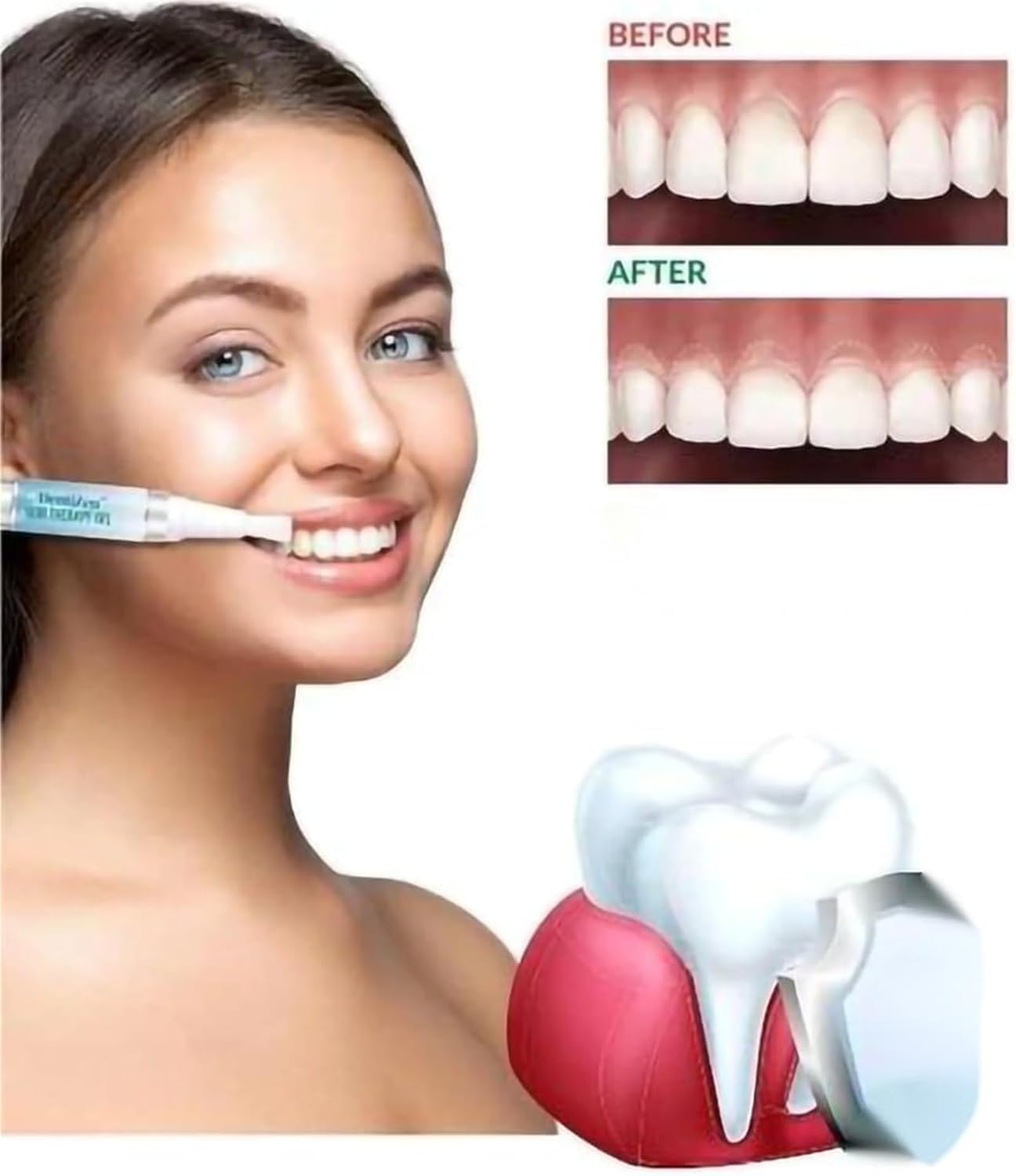 EZ LIVING 4ml Tooth Cleaning Pen – Teeth Whitening Essence for Effective Stain Removal, Plaque Cleaning, and Smile Brightening – Easy-to-Use Oral Care Tool for Daily Use