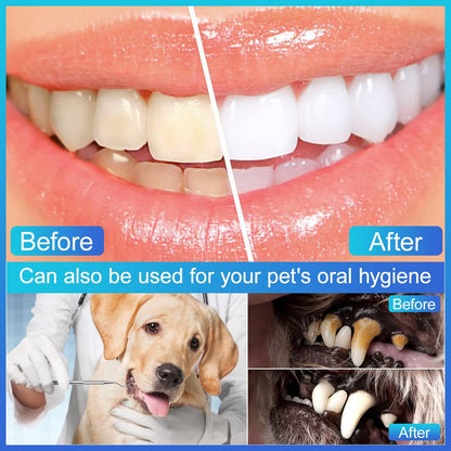 EZ LIVING 3 Pieces Dental Pick Tools Kit Teeth Cleaning Calculus Remover Tool for Dentist Personal Using Pets Oral Care Set with Dental Mirror Dental Tartar Scraper Dental Probe and Storage Box