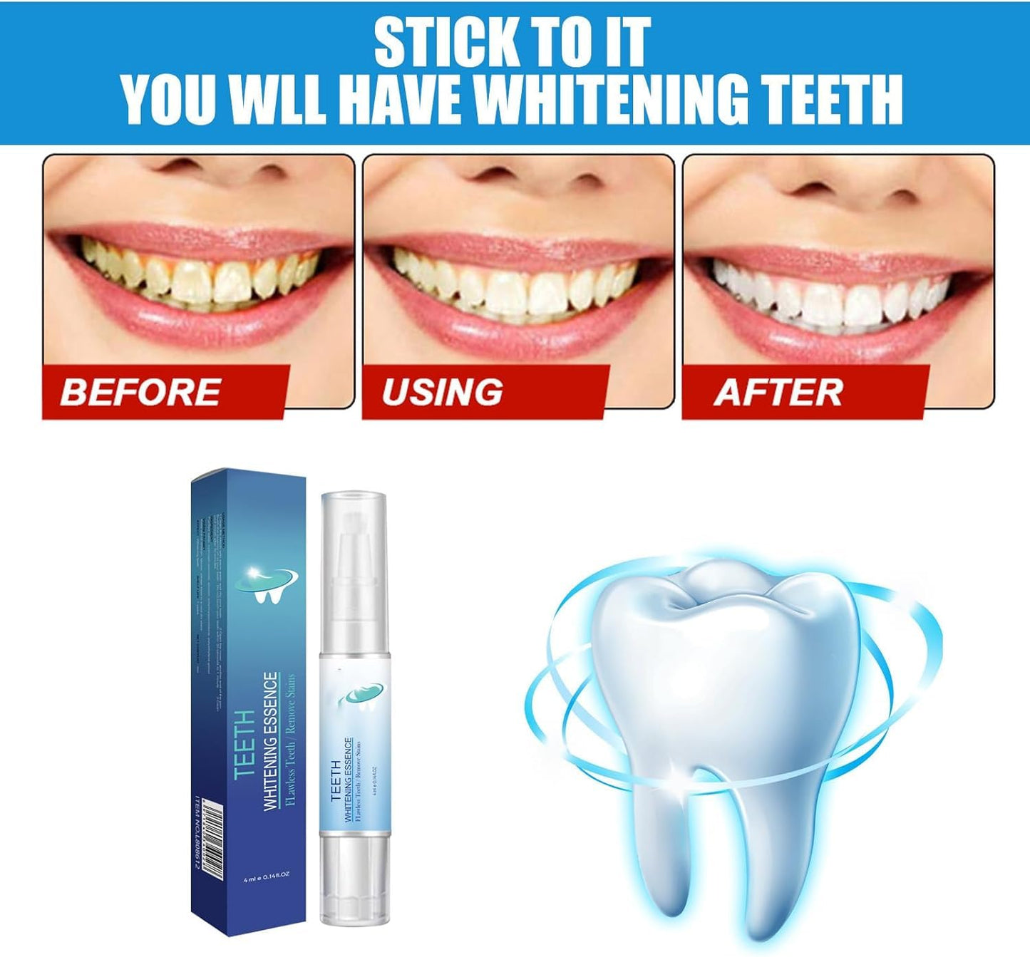 EZ LIVING 4ml Tooth Cleaning Pen – Teeth Whitening Essence for Effective Stain Removal, Plaque Cleaning, and Smile Brightening – Easy-to-Use Oral Care Tool for Daily Use